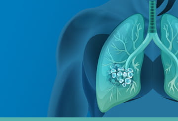 Lungs and Genetic Testing