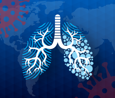 376-x-321-11818---PN---Article-Graphic-Covid-Lung-Cancer-copy